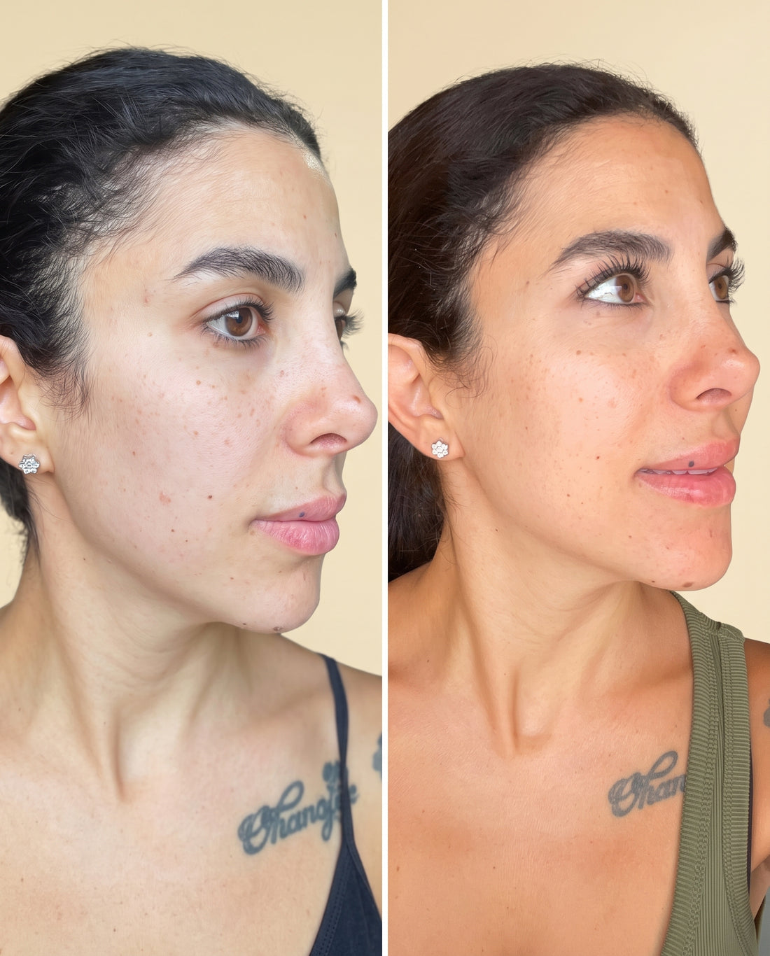 Before and after