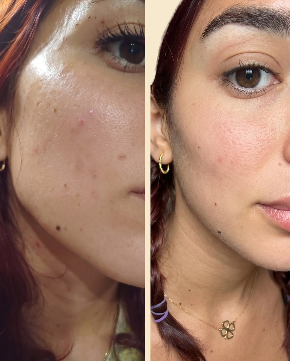 Before and after